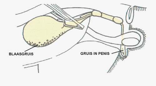 blaasgruis in de blaas